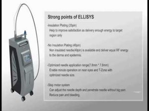 آر اف فرکشنال سوزنی