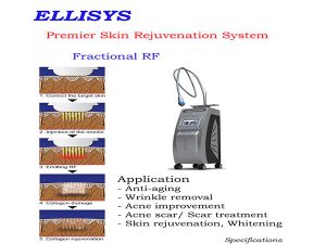 آر اف فرکشنال سوزنی